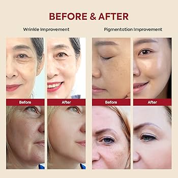 SEOUL 1988 Eye Cream : Retinal Liposome 4% + Fermented Bean