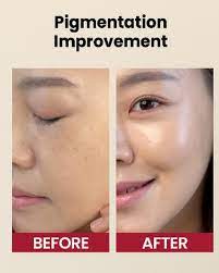 SEOUL 1988 Eye Cream : Retinal Liposome 4% + Fermented Bean